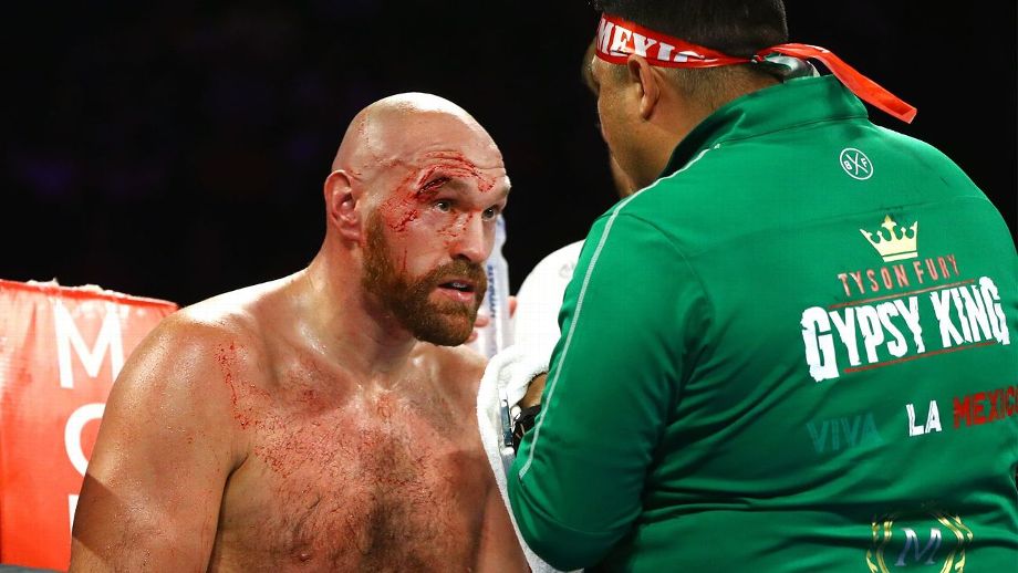 Fury e Capetillo
